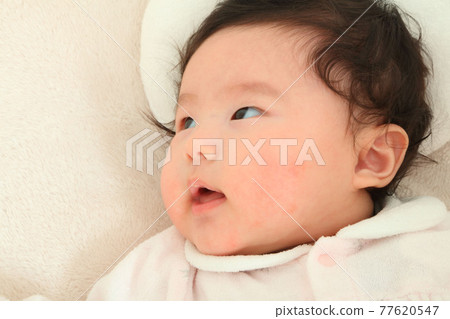 Red Chiyan, baby 77620547