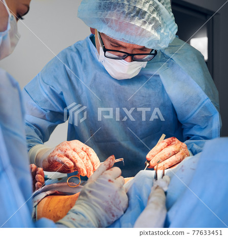 Doctor and assistant doing abdominoplasty surgery in modern clinic. 77633451