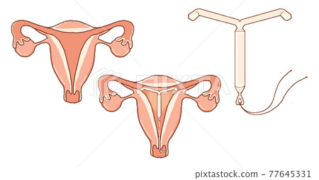 Milena and Uterus: Transparent PNG Milena and Uterus: Transparent PNG 77645331