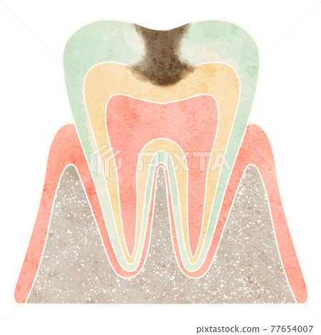 Cross section of cavities (C2) Cross section of cavities (C2) 77654007