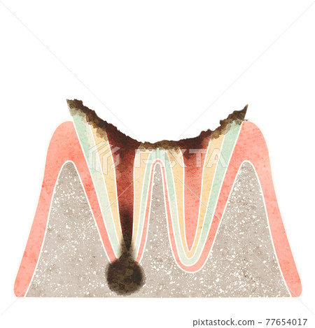 Cross section of cavities (C4) 77654017