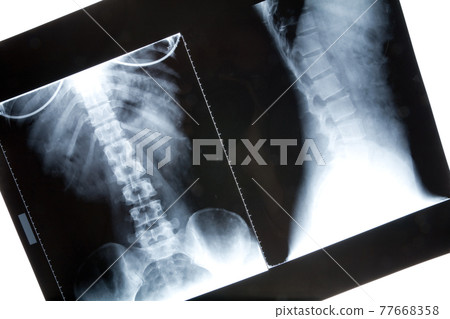 x-ray image x-ray image 77668358