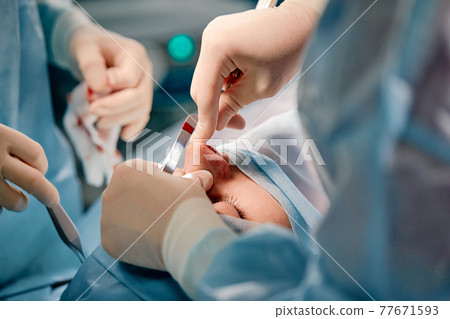 Rhinoplasty men, the surgeon s gloved hands hold the instruments during nose surgery. Doctor in gloves holds a medical instrument during rhinoplasty 77671593