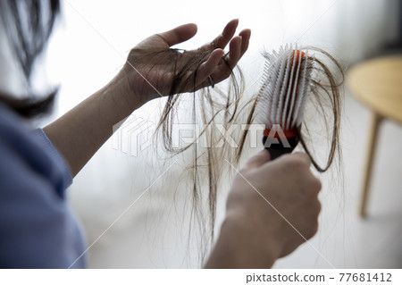 Hair loss image 77681412