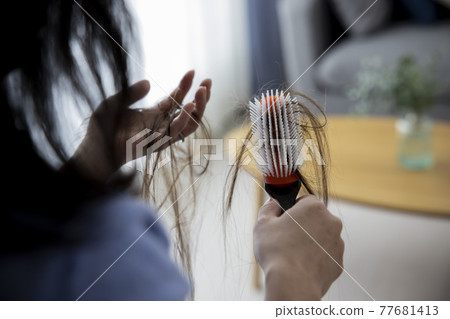 Hair loss image 77681413