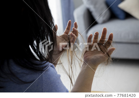 脫髮圖片 脫髮圖片 77681420