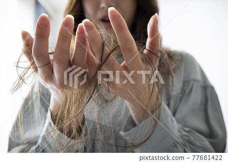 脫髮圖片 脫髮圖片 77681422