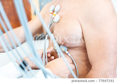 Doctor placing electrodes on patient for ecg Doctor placing electrodes on patient for ecg 77697291
