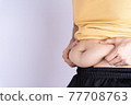 Fat man holding excessive fat belly isolated grey background. 77708763