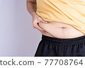 Fat man holding excessive fat belly isolated grey background. 77708764