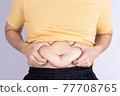 Fat man holding excessive fat belly isolated grey background. 77708765