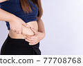 Fat woman holding excessive fat belly isolated grey background. 77708768
