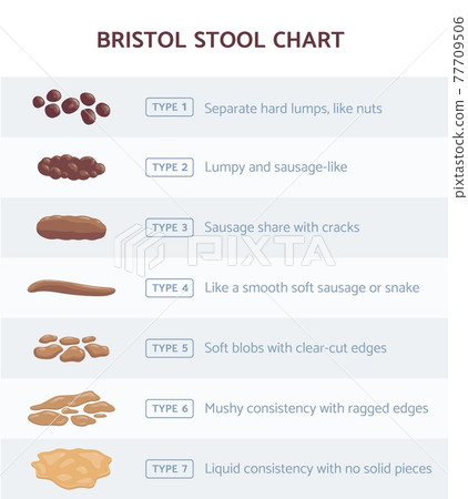 Bristol stool chart for faeces type classification, flat vector illustration. 77709506