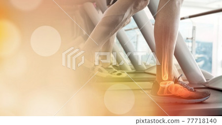 Composition of man running on treadmill with leg bones visible and spots of light 77718140