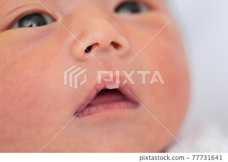 新生兒嘴唇脫皮 77731641