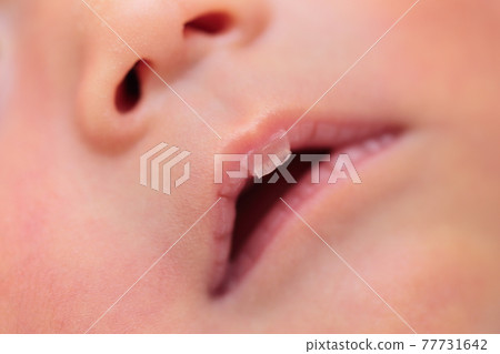 新生兒嘴唇脫皮 77731642