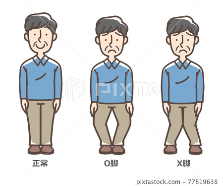 Knee osteoarthritis male Knee osteoarthritis male 77819638