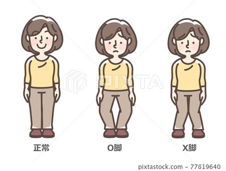 膝關節骨關節炎女性 77819640