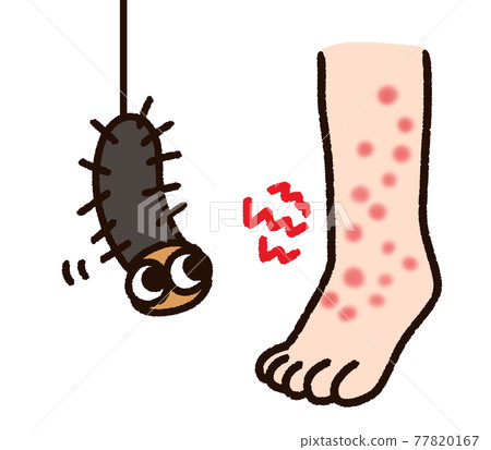 昆蟲咬腿和毛毛蟲 77820167