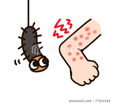 昆蟲咬臂和毛毛蟲 77820168