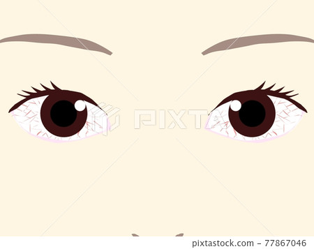 Red-eye eyes 77867046