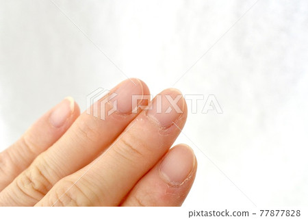 指尖上有倒刺的女性手 77877828
