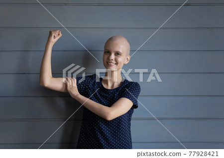 Happy strong cancer patient winning battle for life, getting better 77928421