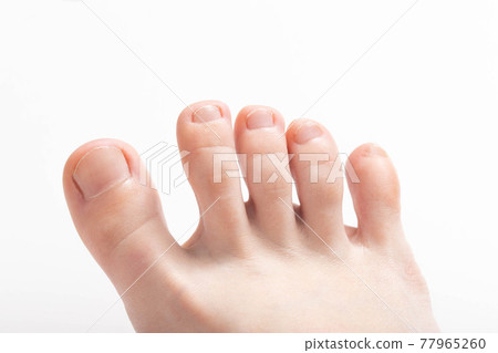 Toes on a white background. Concept of unpleasant foot odor, bacteria and fungus between the toes 77965260