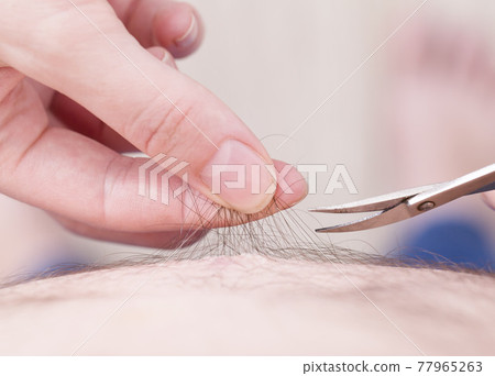 The man cuts the hair from the abdomen with scissors. Hygiene and body care concept, close-up 77965263