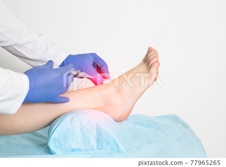 The doctor gives an intra-articular injection of an ankle block to a patient who has a ligament rupture and injury, close-up 77965265