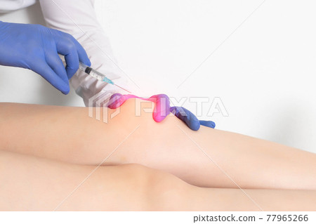 The doctor makes an injection of plasma therapy into the knee joint of the patient after surgery and prosthetics to heal and restore cartilage tissue, copy space for text 77965266