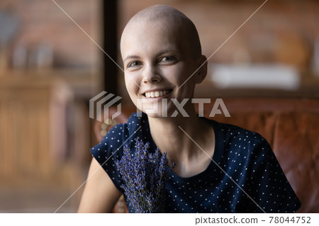 Happy young hairless woman getting good result of treatment 78044752