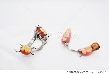 Old maxillary and mandibular partial dentures 78053514