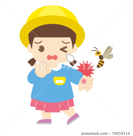 Girl bitten by a bee (without hat) 78059519