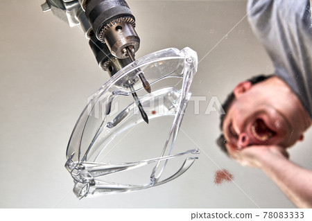 Injury in workplace as result of safety violations. Drill bit pierced of protective glasses. Injury in workplace as result of safety violations. Drill bit pierced of protective glasses. 78083333