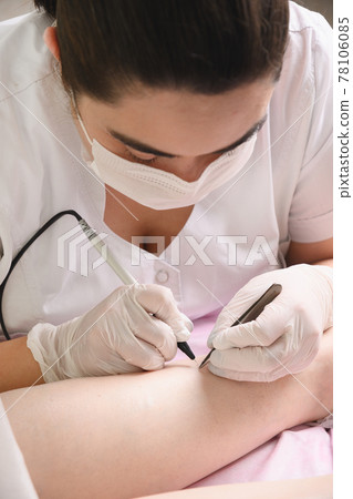 Removal hair from womans legs by electro epilation metod. Cosmetology procedure in beauty cabinet. 78106085