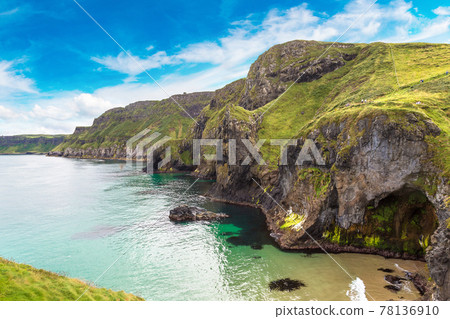 Carrick-a-Rede, Causeway Coast Carrick-a-Rede, Causeway Coast 78136910