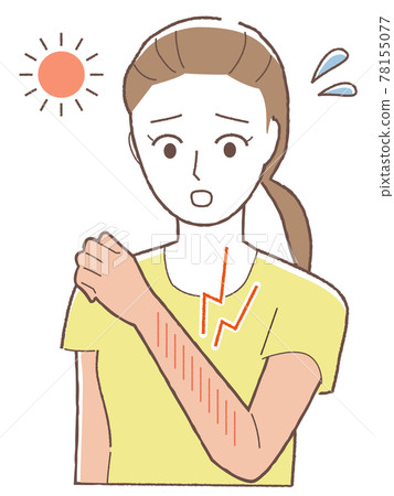 A woman who has tanned her arm 78155077