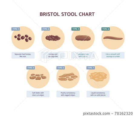 Bristol stool chart with medicine description of human excrements. Bristol stool chart with medicine description of human excrements. 78162320