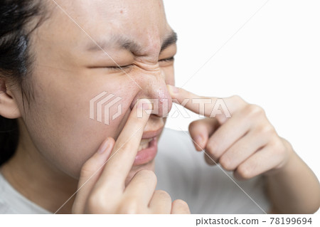 Asian teenager girl squeezing pimples,problem of inflammation acne on face,lady woman with a painful facial expression while popping a pimple,acne spots or blackhead on her nose, skin care concept Asian teenager girl squeezing pimples,problem of inflammation acne on face,lady woman with a painful facial expression while popping a pimple,acne spots or blackhead on her nose, skin care concept 78199694