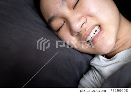 Asian child girl suffering from bruxism while lying in bed at night,female grinding of the teeth during sleep,teeth clenching,sleep disorders,oral health problems,dental care medical,bruxism concept Asian child girl suffering from bruxism while lying in bed at night,female grinding of the teeth during sleep,teeth clenching,sleep disorders,oral health problems,dental care medical,bruxism concept 78199698