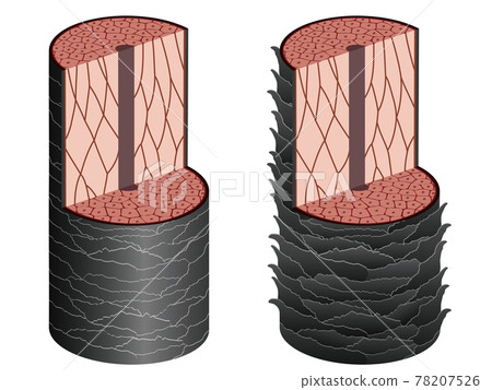 頭髮橫截面機制 78207526