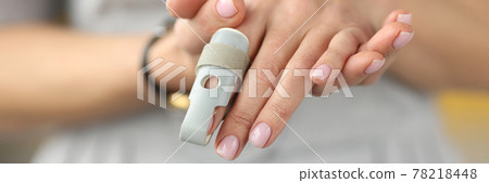 Orthopedic orthosis fixing joints of hand finger closeup Orthopedic orthosis fixing joints of hand finger closeup 78218448