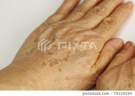 手背有污漬 手背有污漬 78220284
