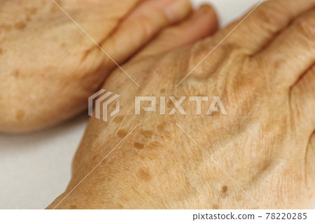 手背有污漬 手背有污漬 78220285