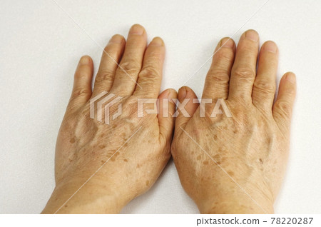 Back of hand with stains 78220287