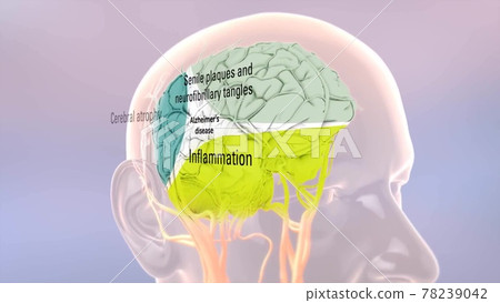 Amyloid Precursor Protein Processing and Alzheimer's Disease Amyloid Precursor Protein Processing and Alzheimer's Disease 78239042