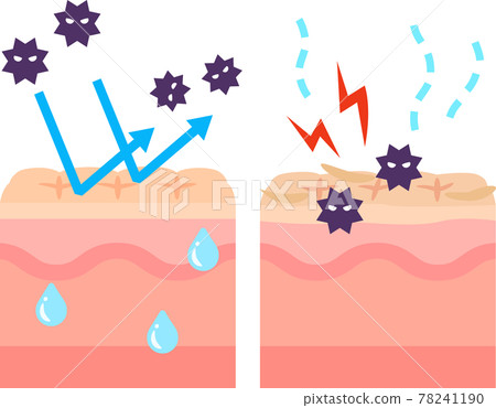 Cross section of skin with barrier function and rough skin Cross section of skin with barrier function and rough skin 78241190