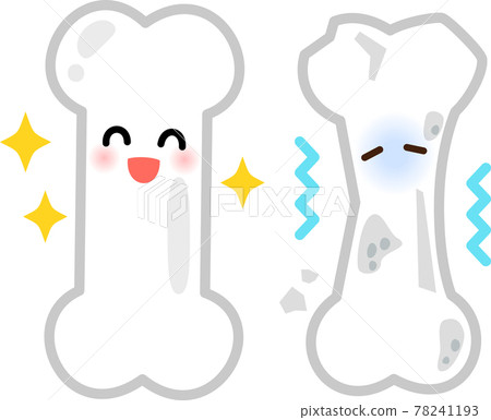 健康骨骼和脆骨特徵 健康骨骼和脆骨特徵 78241193