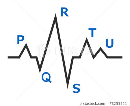 檢查心臟波長的心電圖圖示 檢查心臟波長的心電圖圖示 78255321